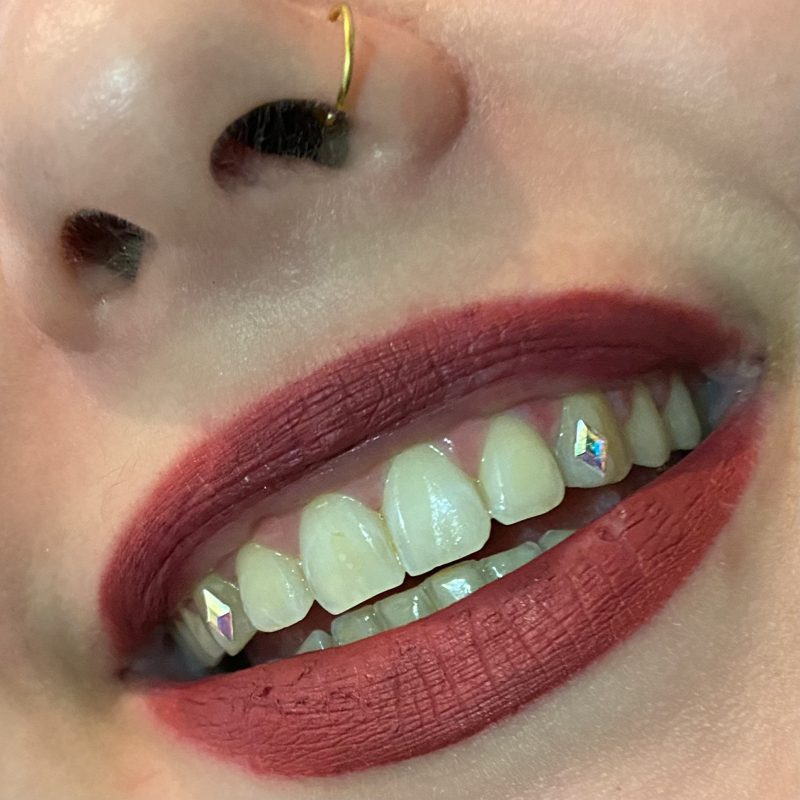 strass dentaire lyon nail art lyon