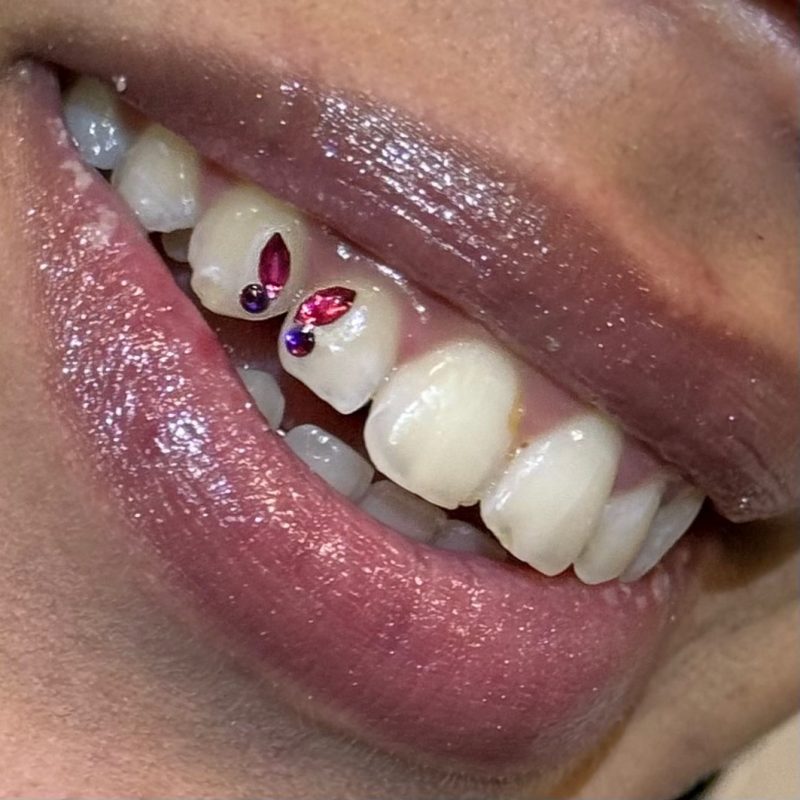 strass dentaire lyon nail art lyon