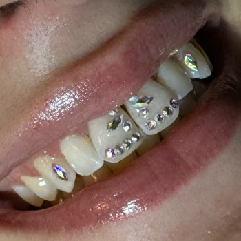 Samantha Vonviper Strass Dentaire