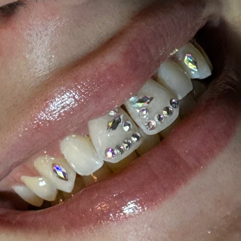 strass dentaire lyon nail art lyon