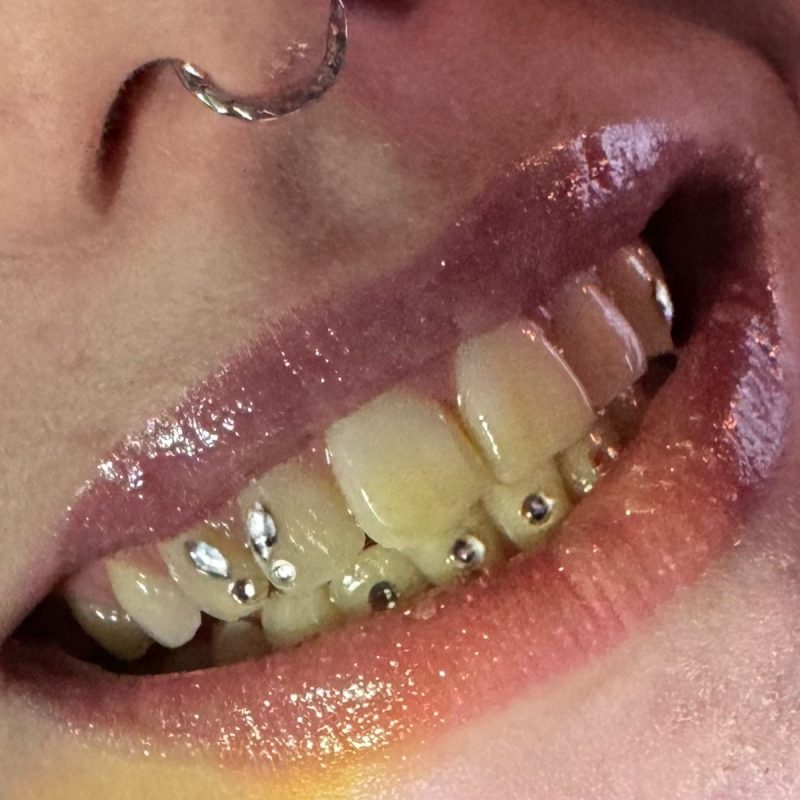 strass dentaire lyon nail art lyon